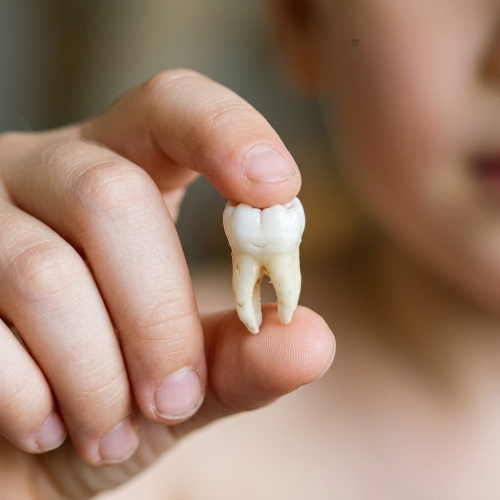 Ребенок выбил постоянный зуб: что делать в первые 30 минут